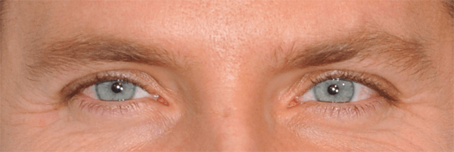 celebrity eye image